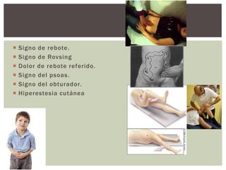  Signo de rebote.
 Signo de Rovsing
 Dolor de rebote referido.
 Signo del psoas.
 Signo del obturador.
 Hiperestesia cutánea
 