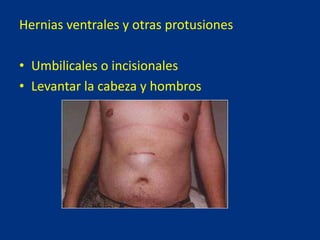 Hernias ventrales y otras protusiones
• Umbilicales o incisionales
• Levantar la cabeza y hombros
 