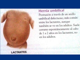 Técnicas de exploración abdominal