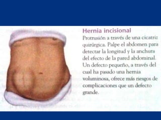 Técnicas de exploración abdominal