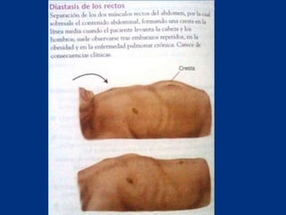 Técnicas de exploración abdominal