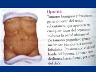 Técnicas de exploración abdominal
