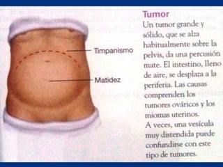 Técnicas de exploración abdominal