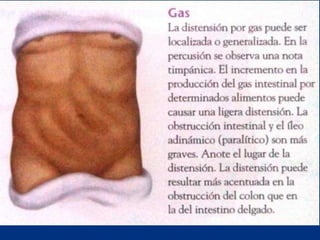 Técnicas de exploración abdominal