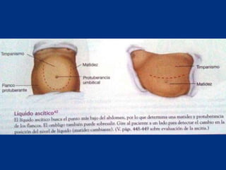 Técnicas de exploración abdominal