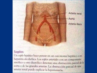 Técnicas de exploración abdominal