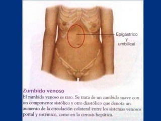 Técnicas de exploración abdominal