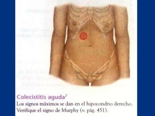 Técnicas de exploración abdominal
