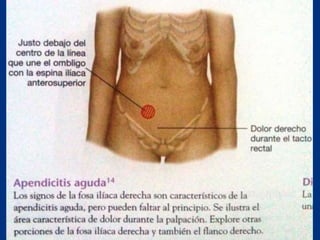 Técnicas de exploración abdominal