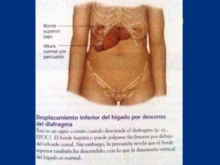Técnicas de exploración abdominal