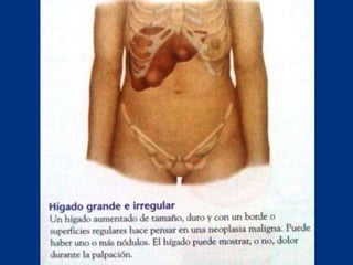 Técnicas de exploración abdominal