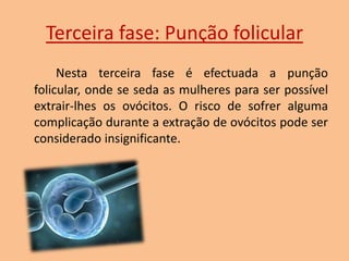 Terceira fase: Punção folicular
Nesta terceira fase é efectuada a punção
folicular, onde se seda as mulheres para ser possível
extrair-lhes os ovócitos. O risco de sofrer alguma
complicação durante a extração de ovócitos pode ser
considerado insignificante.

 