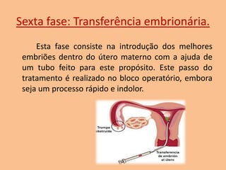 Sexta fase: Transferência embrionária.
Esta fase consiste na introdução dos melhores
embriões dentro do útero materno com a ajuda de
um tubo feito para este propósito. Este passo do
tratamento é realizado no bloco operatório, embora
seja um processo rápido e indolor.

 