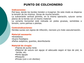 Indicaciones:
Piel laxa, donde los bordes tienden a invaginar. De este modo se dispersa
la tensión de los mismos. Zonas de mucha tensión.
La subvariante vertical permite, en la misma operación, suturar varios
planos de la herida con el mismo material.
La variante horizontal está indicada en pieles gruesas, sometidas a
tensión, como palmas o plantas.
Contraindicaciones:
Heridas sucias con signos de infección, necrosis y/o mala vascularización.
Material necesario:
•Anestésico
•Suero fisiológico
•Paños asépticos, guantes, desinfectante
Material de cirugía:
•Tijeras de punta recta
•Material de sutura con aguja: el adecuado según el tipo de piel, la
herida, etc.
•Porta agujas
•Mosquito
•Pinzas (con o sin dientes)
PUNTO DE COLCHONERO
 