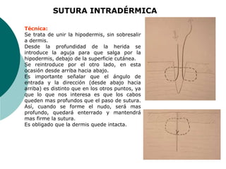 SUTURA INTRADÉRMICA
Técnica:
Se trata de unir la hipodermis, sin sobresalir
a dermis.
Desde la profundidad de la herida se
introduce la aguja para que salga por la
hipodermis, debajo de la superficie cutánea.
Se reintroduce por el otro lado, en esta
ocasión desde arriba hacia abajo.
Es importante señalar que el ángulo de
entrada y la dirección (desde abajo hacia
arriba) es distinto que en los otros puntos, ya
que lo que nos interesa es que los cabos
queden mas profundos que el paso de sutura.
Así, cuando se forme el nudo, será mas
profundo, quedará enterrado y mantendrá
mas firme la sutura.
Es obligado que la dermis quede intacta.
 