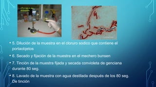 Técnicas de tinción