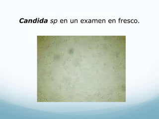 Candida sp en un examen en fresco.
 
