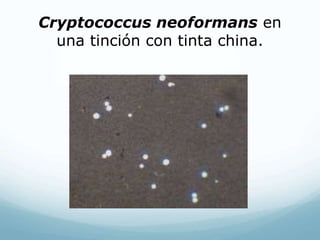 Cryptococcus neoformans en
una tinción con tinta china.
 