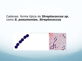 Cadenas: forma típica de Streptococcus sp,
como S. pneumoniae, Streptococcus
 