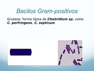 Bacilos Gram-positivos
Gruesos: forma típica de Clostridium sp, como
C. perfringens, C. septicum
 
