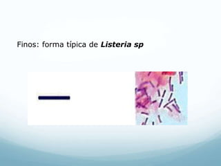 Finos: forma típica de Listeria sp
 