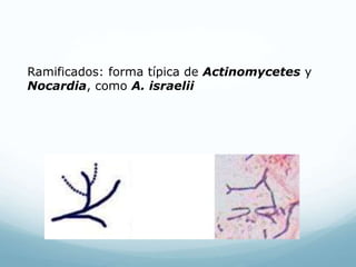 Ramificados: forma típica de Actinomycetes y
Nocardia, como A. israelii
 
