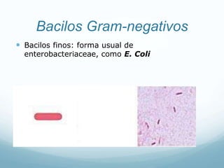 Bacilos Gram-negativos
 Bacilos finos: forma usual de
enterobacteriaceae, como E. Coli
 