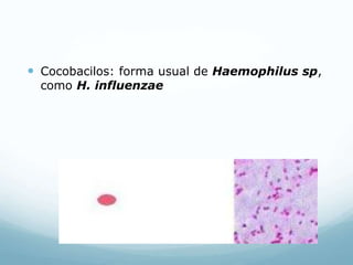  Cocobacilos: forma usual de Haemophilus sp,
como H. influenzae
 