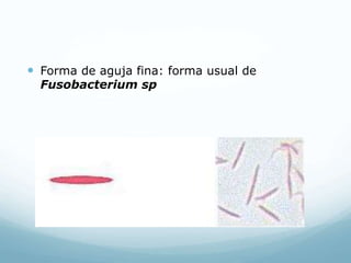  Forma de aguja fina: forma usual de
Fusobacterium sp
 