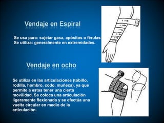Se usa para: sujetar gasa, apósitos o férulas
Se utiliza: generalmente en extremidades.




Se utiliza en las articulaciones (tobillo,
rodilla, hombro, codo, muñeca), ya que
permite a estas tener una cierta
movilidad. Se coloca una articulación
ligeramente flexionada y se efectúa una
vuelta circular en medio de la
articulación.
 