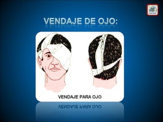 Técnicas de vendaje e inmovilización.