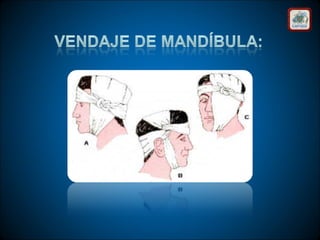 Técnicas de vendaje e inmovilización.