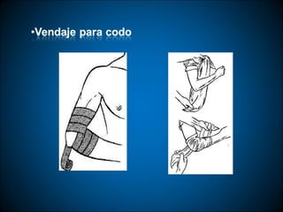 Técnicas de vendaje e inmovilización.