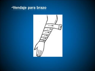 Técnicas de vendaje e inmovilización.