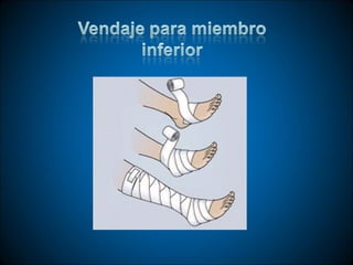 Técnicas de vendaje e inmovilización.