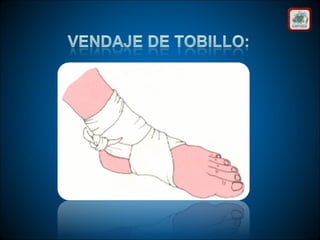 Técnicas de vendaje e inmovilización.