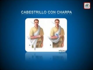 Técnicas de vendaje e inmovilización.