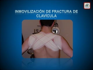 Técnicas de vendaje e inmovilización.