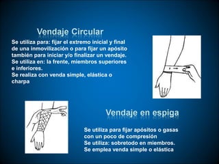 Se utiliza para: fijar el extremo inicial y final
de una inmovilización o para fijar un apósito
también para iniciar y/o finalizar un vendaje.
Se utiliza en: la frente, miembros superiores
e inferiores.
Se realiza con venda simple, elástica o
charpa




                              Se utiliza para fijar apósitos o gasas
                              con un poco de compresión
                              Se utiliza: sobretodo en miembros.
                              Se emplea venda simple o elástica
 