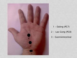 1 – Daling (PC7)
2 – Lao Gong (PC8)
3 – Gastrointestinal
 