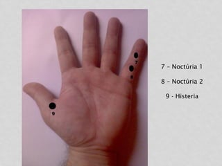 7 – Noctúria 1
8 – Noctúria 2
9 - Histeria
 