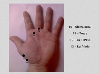10 – Úlcera Bucal
11 – Tosse
12 – Yu Ji (P10)
13 – Resfriado
 