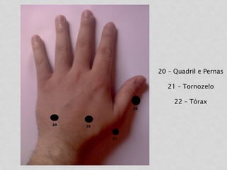 20 – Quadril e Pernas
21 – Tornozelo
22 – Tórax
 