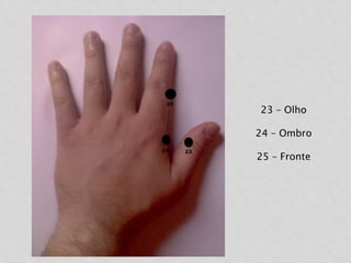 23 – Olho
24 – Ombro
25 – Fronte
 