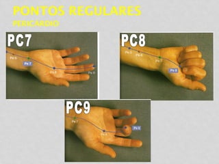 PONTOS REGULARES
PERICÁRDIO
 