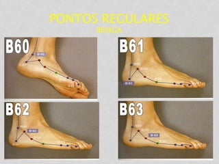 PONTOS REGULARES
BEXIGA
 