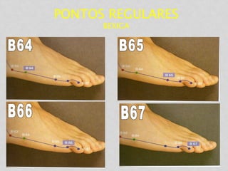 PONTOS REGULARES
BEXIGA
 