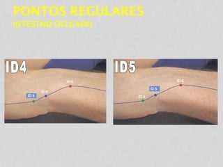 PONTOS REGULARES
INTESTNO DELGADO
 