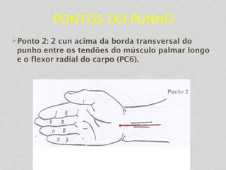 PONTOS DO PUNHO
Ponto 2: 2 cun acima da borda transversal do
punho entre os tendões do músculo palmar longo
e o flexor radial do carpo (PC6).
 