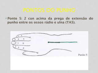 PONTOS DO PUNHO
Ponto 5: 2 cun acima da prega de extensão do
punho entre os ossos rádio e ulna (TA5).
 